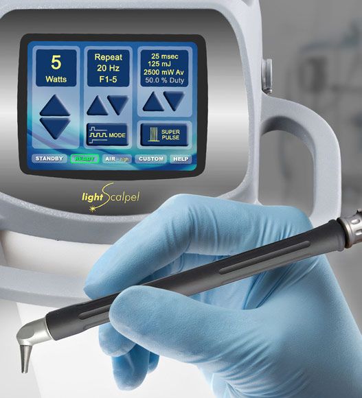 Laser dentistry system for lip and tongue tie