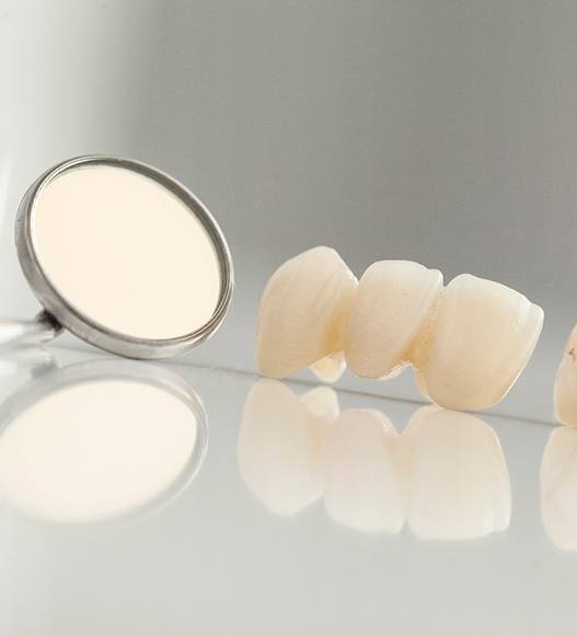 a traditional dental bridge next to a dental mirror