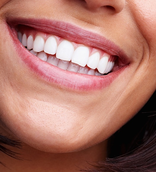 Closeup of smile after cosmetic dental bonding