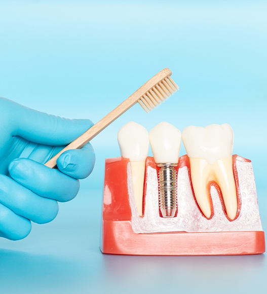 Model of dental implant supported replacement tooth compared to natural teeth