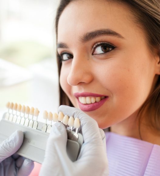 Woman's smile compared with porcelain veneer shade chart during cosmetic dentistry visit