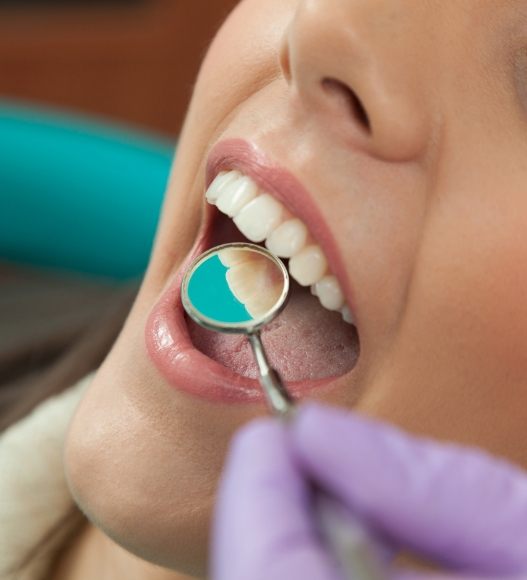 Dentist examining patient's smile during metal free dental crown placement