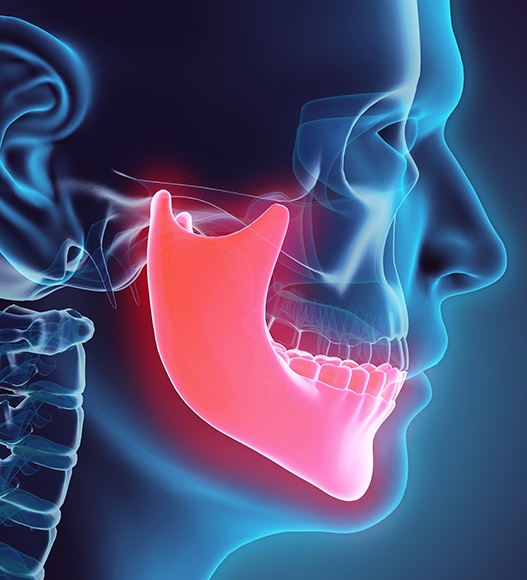 Animated jaw and skull bone indicating T M J disorder