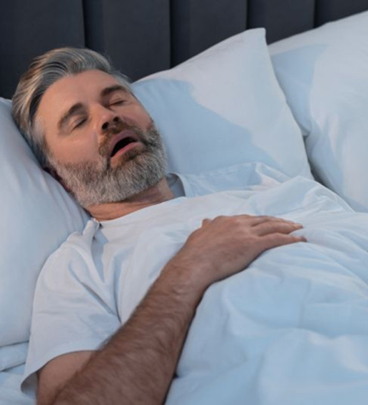 Man snoring in white bed linens
