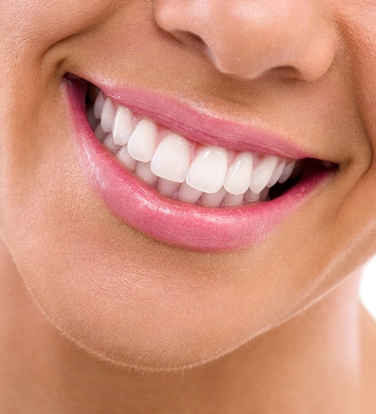 Close-up of woman’s perfect teeth with veneers in Eugene