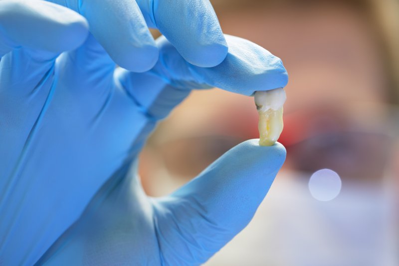 Gloved hand holding an extracted tooth